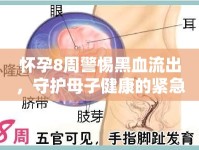 懷孕8周警惕黑血流出，守護(hù)母子健康的緊急提示