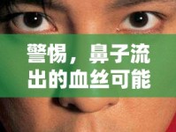 警惕，鼻子流出的血絲可能是健康微小信號(hào)