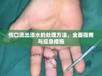 傷口流出清水的處理方法，全面指南與應(yīng)急措施