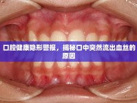 口腔健康隱形警報，揭秘口中突然流出血絲的原因