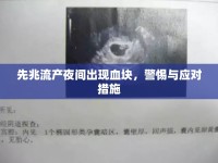 先兆流產夜間出現(xiàn)血塊，警惕與應對措施