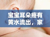 寶寶耳朵疼有黃水流出，家長(zhǎng)必知的護(hù)理與預(yù)防指南