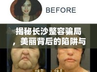 揭秘長(zhǎng)沙整容騙局，美麗背后的陷阱與警示