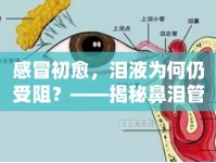 感冒初愈，淚液為何仍受阻？——揭秘鼻淚管與感冒的后遺效應