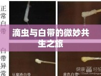 滴蟲(chóng)與白帶的微妙共生之旅