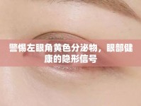 警惕左眼角黃色分泌物，眼部健康的隱形信號