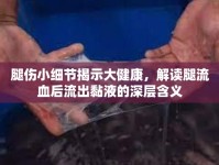 腿傷小細(xì)節(jié)揭示大健康，解讀腿流血后流出黏液的深層含義