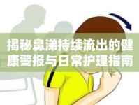 揭秘鼻涕持續(xù)流出的健康警報與日常護理指南