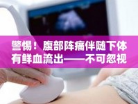 警惕！腹部陣痛伴隨下體有鮮血流出——不可忽視的身體健康信號(hào)