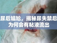 尿后尷尬，揭秘尿失禁后為何會有粘液流出
