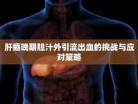 肝癌晚期膽汁外引流出血的挑戰(zhàn)與應(yīng)對(duì)策略