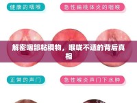解密咽部粘稠物，喉嚨不適的背后真相