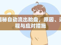 揭秘自動流出胎盤，原因、過程與應(yīng)對措施