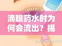 滴眼藥水時為何會流出？揭秘眼部用藥的小困擾