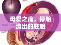 母愛之痛，停胎流出的胚胎
