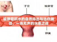 輸卵管積水的自然排出與治療路徑，一場(chǎng)無(wú)聲的水患之戰(zhàn)