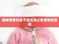 揭秘感冒時(shí)鼻子流出淡紅色液體的真相