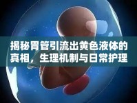 揭秘胃管引流出黃色液體的真相，生理機制與日常護理的全面解析