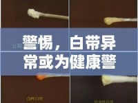 警惕，白帶異常或?yàn)榻】稻? />									</div>
			</a>
			<div   id=