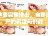 孕囊完整排出，自然流產(chǎn)的希望與挑戰(zhàn)