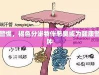 警惕，褐色分泌物伴惡臭或?yàn)榻】稻? />									</div>
			</a>
			<div   id=