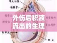 外傷后積液流出的生理機制與日常護理全面解析