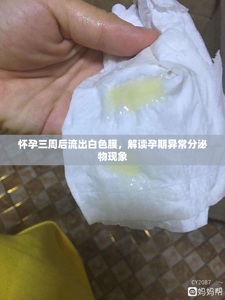 懷孕三周后流出白色膜，解讀孕期異常分泌物現(xiàn)象