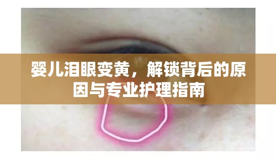 嬰兒淚眼變黃，解鎖背后的原因與專業(yè)護理指南