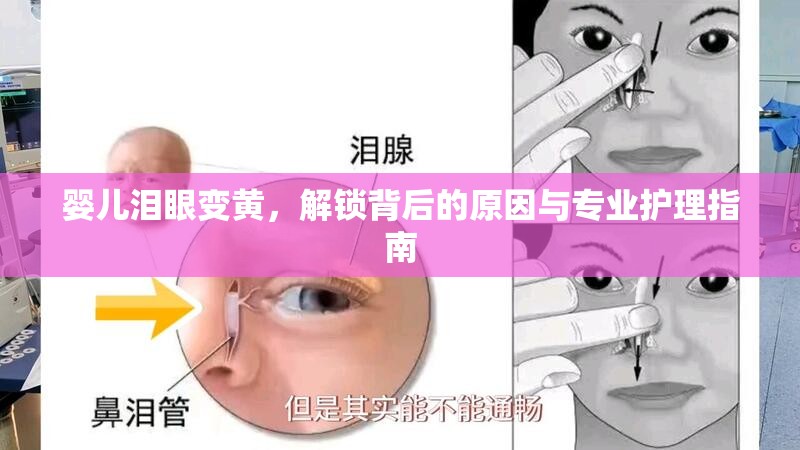 嬰兒淚眼變黃，解鎖背后的原因與專業(yè)護理指南