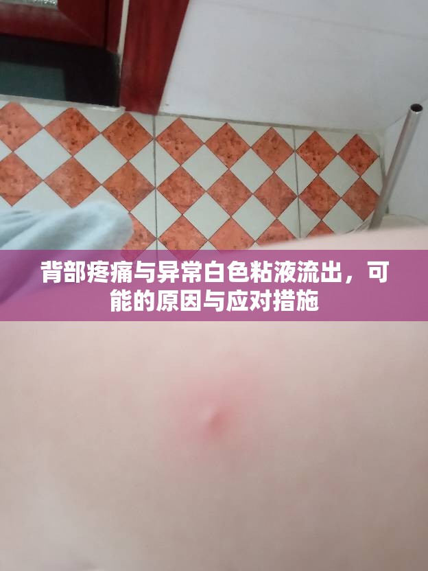 背部疼痛與異常白色粘液流出，可能的原因與應對措施
