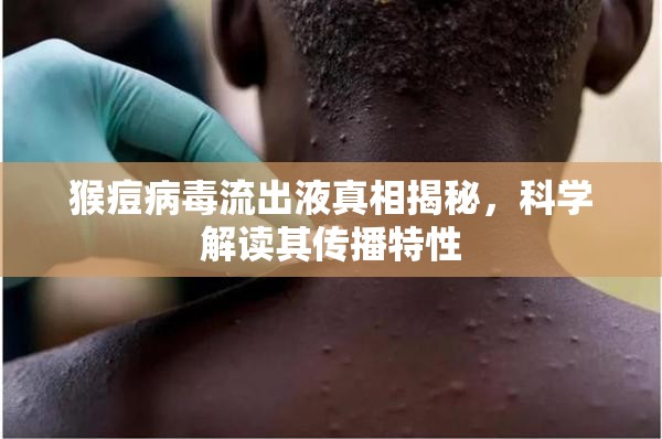 猴痘病毒流出液真相揭秘，科學(xué)解讀其傳播特性