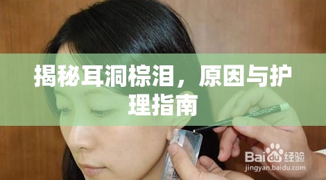 揭秘耳洞棕淚，原因與護理指南