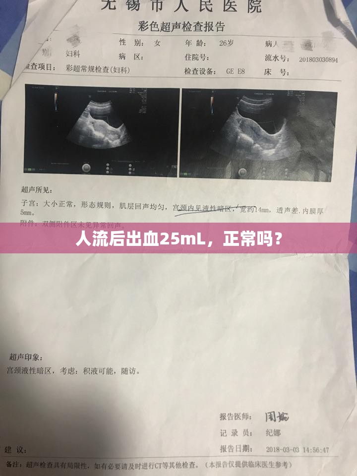 人流后出血25mL，正常嗎？