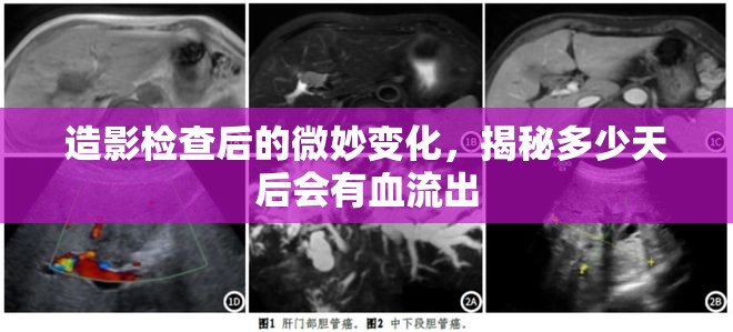 造影檢查后的微妙變化，揭秘多少天后會有血流出