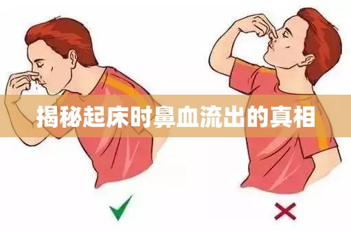 揭秘起床時鼻血流出的真相
