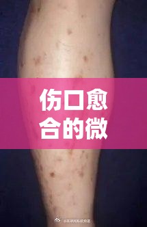 傷口愈合的微妙信號(hào)，結(jié)痂后出現(xiàn)白色血水的含義