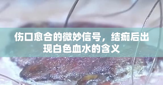 傷口愈合的微妙信號(hào)，結(jié)痂后出現(xiàn)白色血水的含義