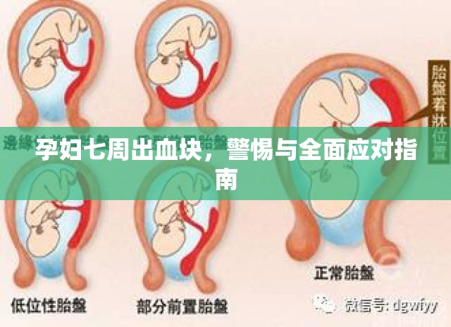 孕婦七周出血塊，警惕與全面應對指南