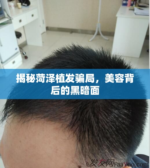揭秘菏澤植發(fā)騙局，美容背后的黑暗面