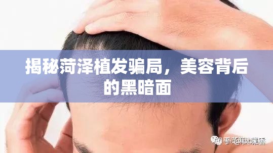 揭秘菏澤植發(fā)騙局，美容背后的黑暗面