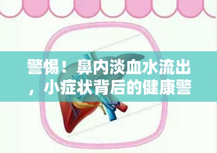 警惕！鼻內(nèi)淡血水流出，小癥狀背后的健康警鐘
