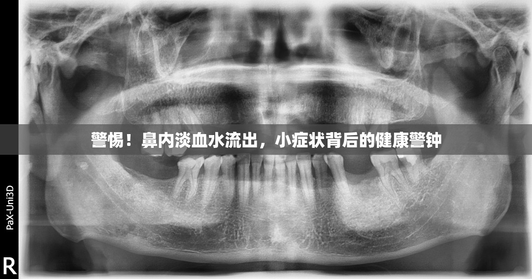 警惕！鼻內(nèi)淡血水流出，小癥狀背后的健康警鐘