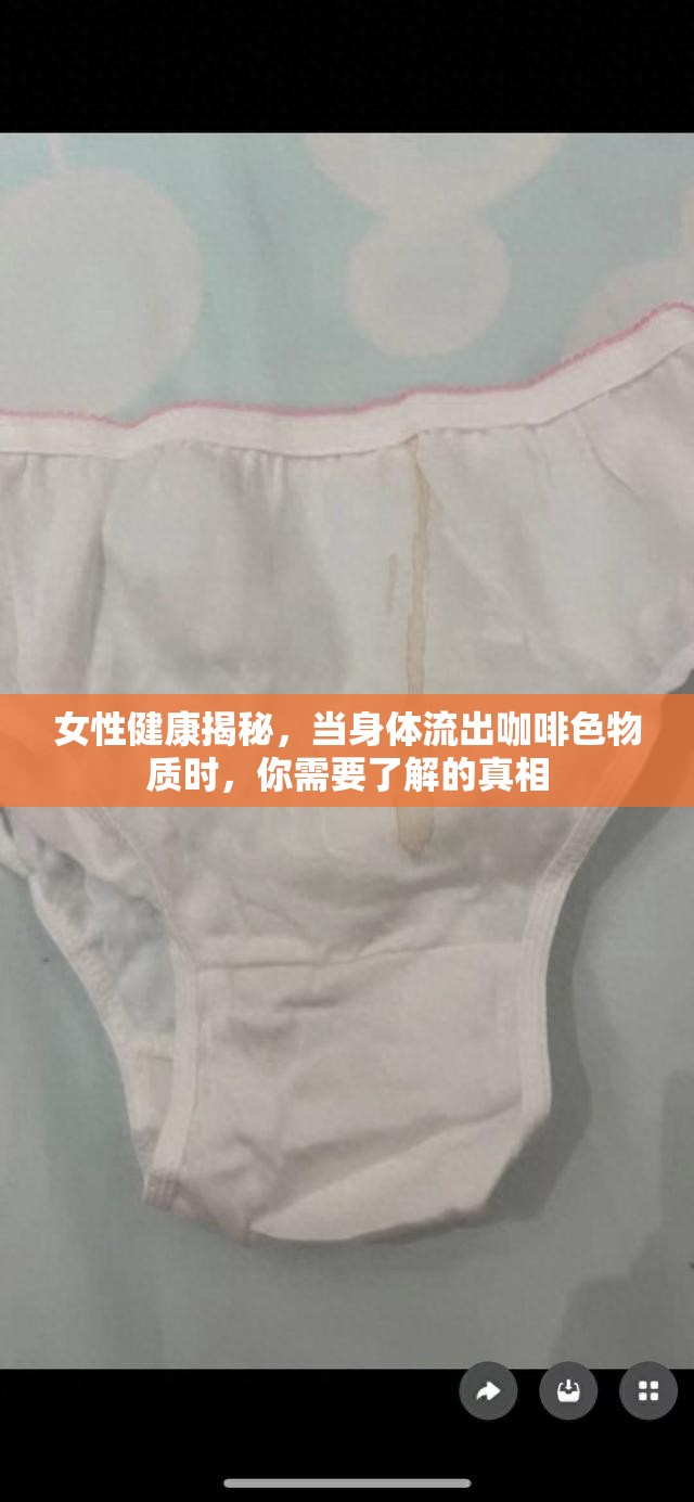 女性健康揭秘，當(dāng)身體流出咖啡色物質(zhì)時(shí)，你需要了解的真相