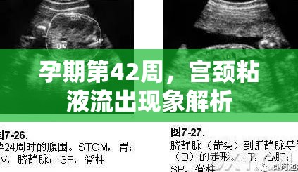 孕期第42周，宮頸粘液流出現(xiàn)象解析