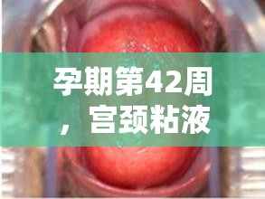 孕期第42周，宮頸粘液流出現(xiàn)象解析