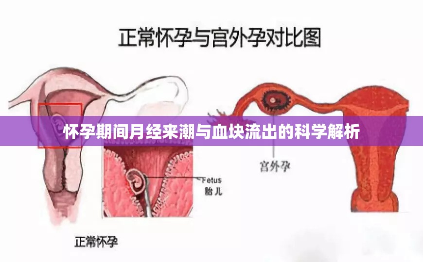 懷孕期間月經(jīng)來潮與血塊流出的科學(xué)解析