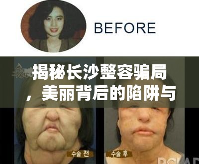 揭秘長沙整容騙局，美麗背后的陷阱與警示