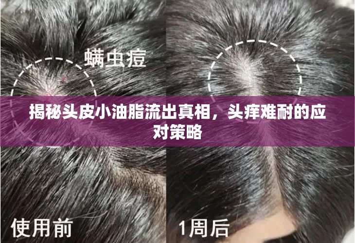 揭秘頭皮小油脂流出真相，頭癢難耐的應對策略