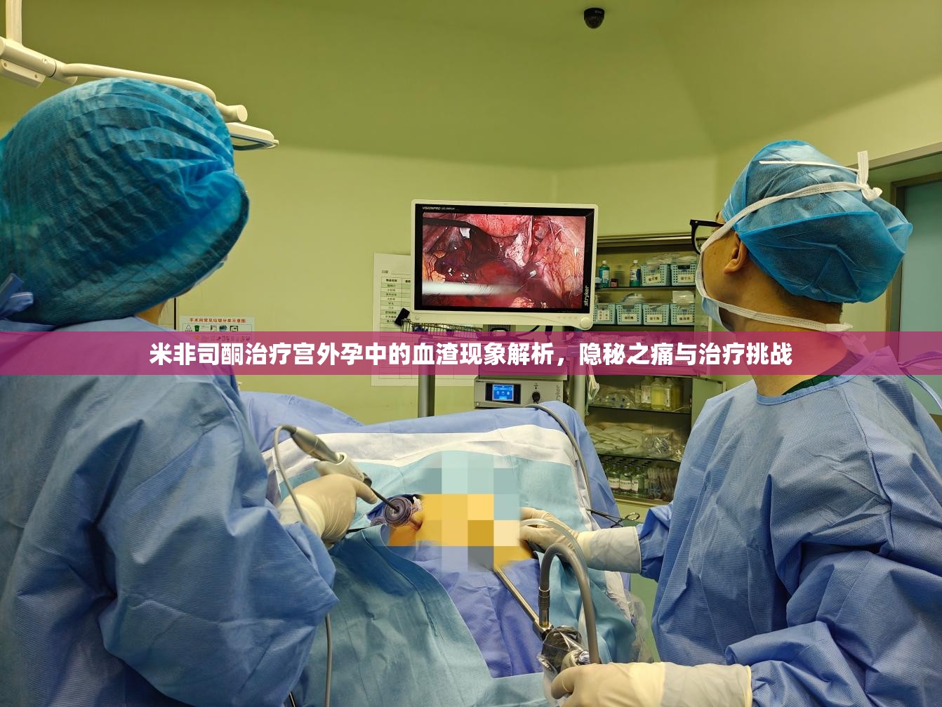 米非司酮治療宮外孕中的血渣現(xiàn)象解析，隱秘之痛與治療挑戰(zhàn)