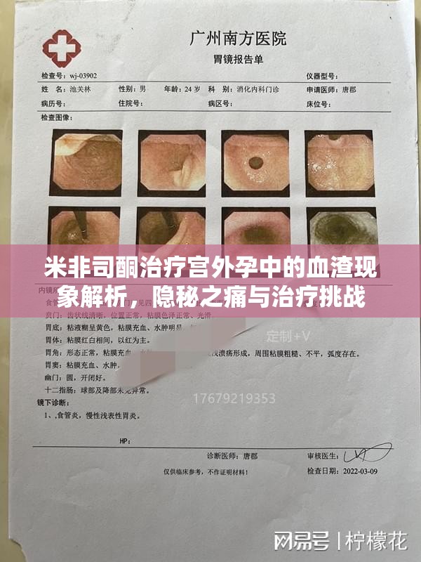 米非司酮治療宮外孕中的血渣現(xiàn)象解析，隱秘之痛與治療挑戰(zhàn)